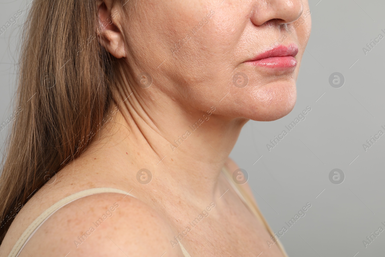 Woman before cosmetic procedure on grey background, closeup Photo of Woman before cosmetic procedure on grey background, closeup