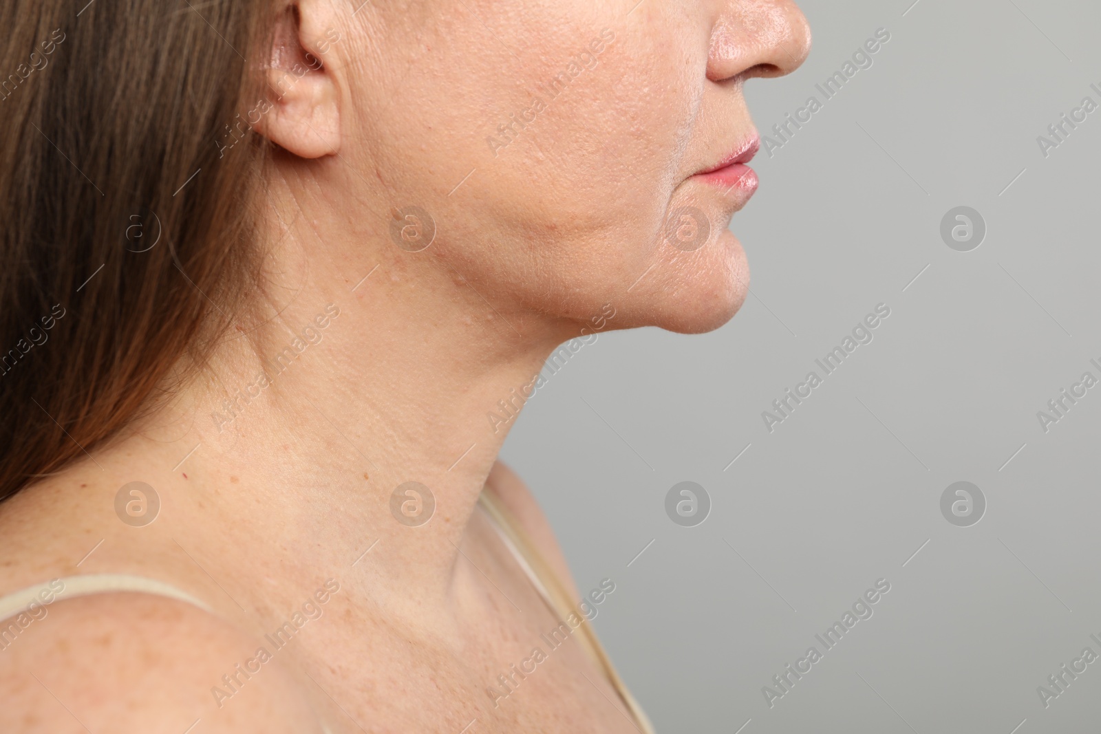 Woman before cosmetic procedure on grey background, closeup. Space for text Photo of Woman before cosmetic procedure on grey background, closeup. Space for text