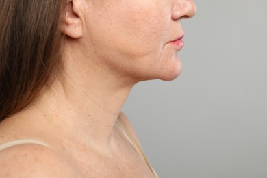 Photo of Woman before cosmetic procedure on grey background, closeup. Space for text