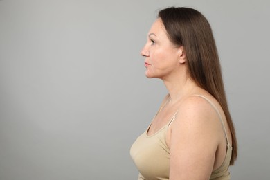 Photo of Woman before cosmetic procedure on grey background, space for text