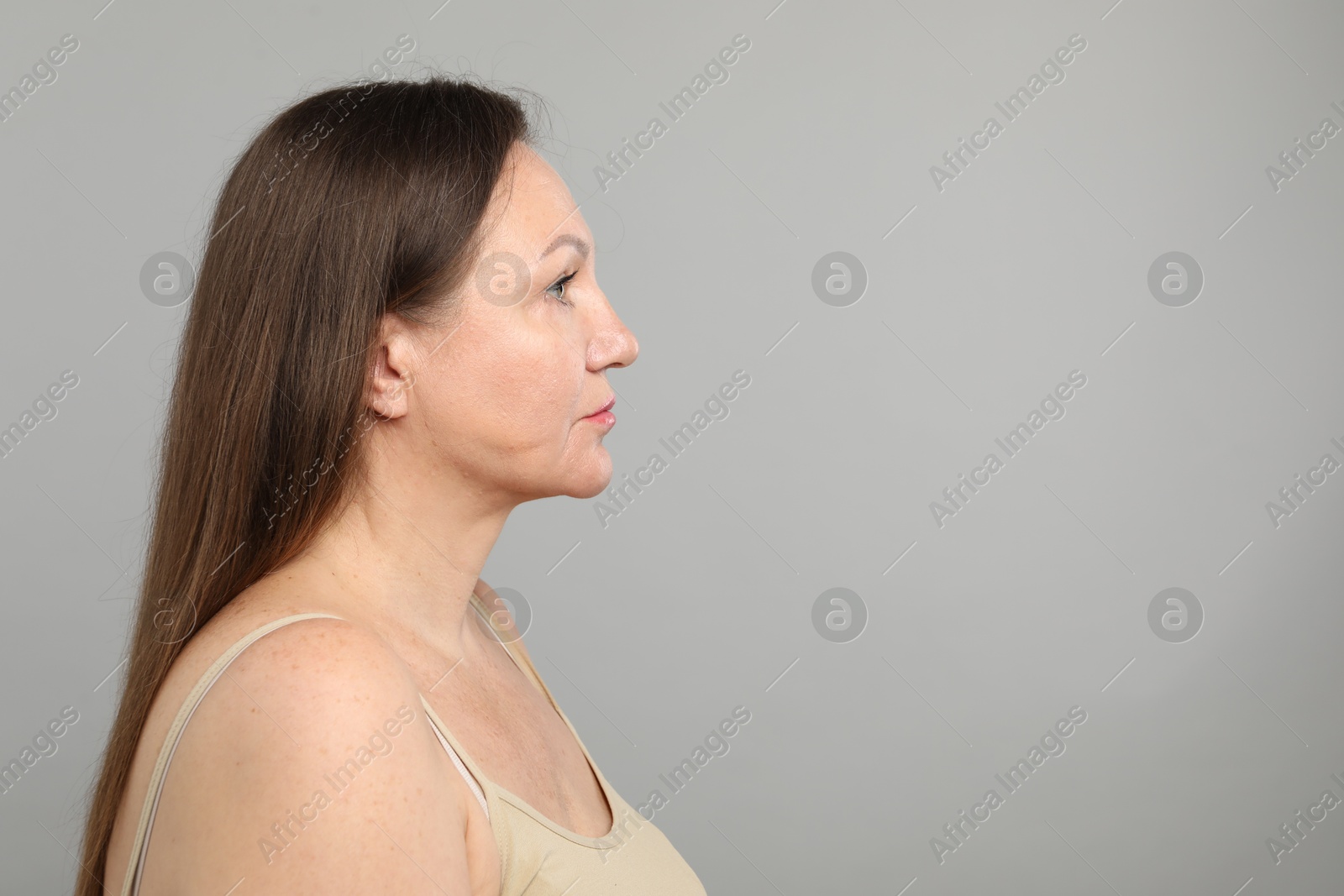 Woman before cosmetic procedure on grey background, space for text Photo of Woman before cosmetic procedure on grey background, space for text