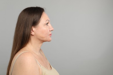 Photo of Woman before cosmetic procedure on grey background, space for text