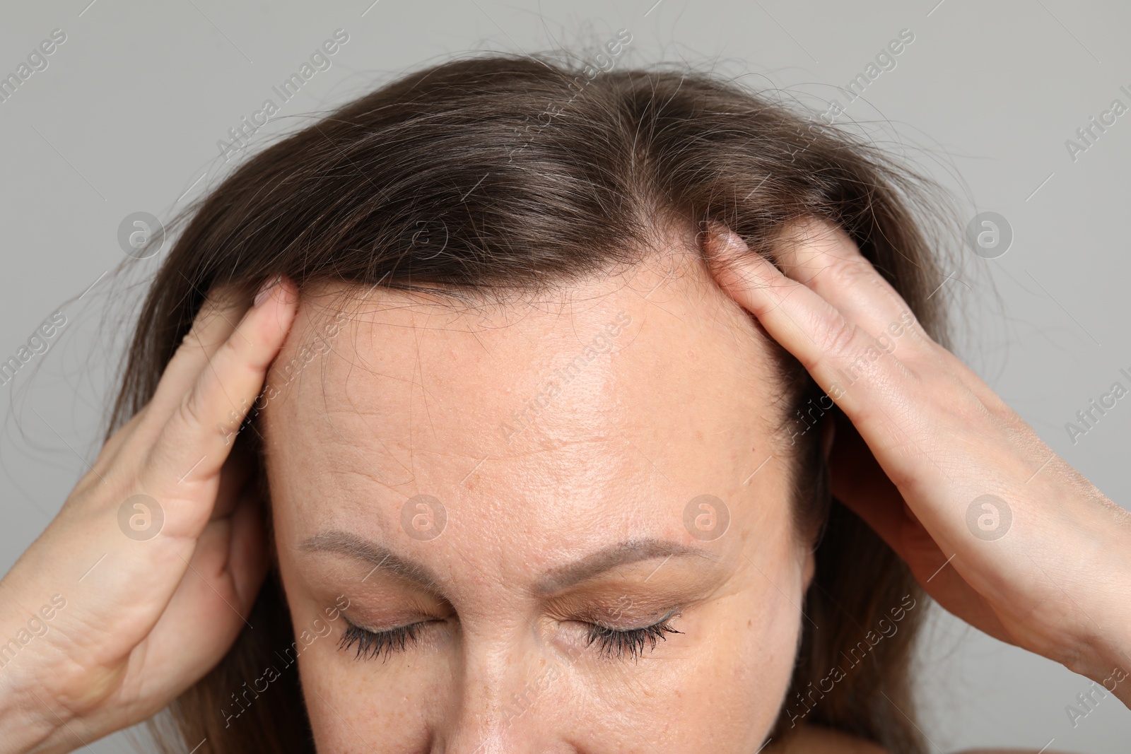 Photo of Woman before rejuvenation on grey background, closeup