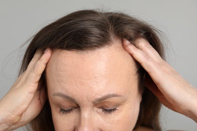 Photo of Woman before rejuvenation on grey background, closeup