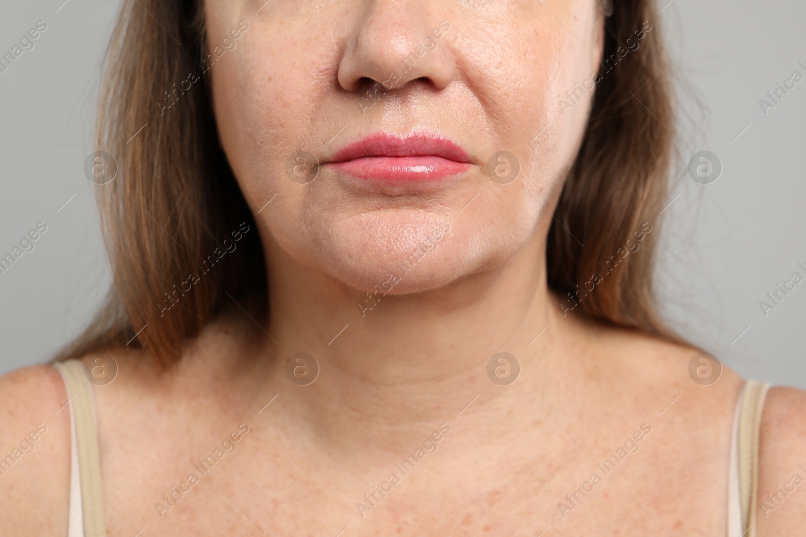 Photo of Woman before cosmetic procedure on grey background, closeup