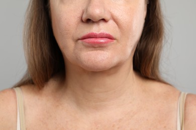 Photo of Woman before cosmetic procedure on grey background, closeup