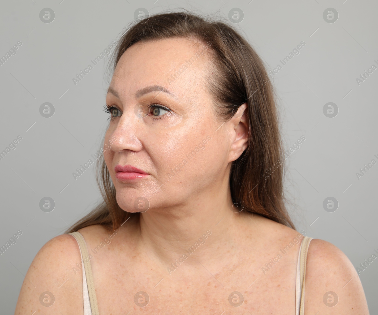 Woman before cosmetic procedure on grey background Photo of Woman before cosmetic procedure on grey background
