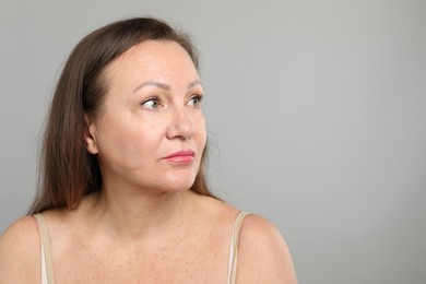 Photo of Woman before cosmetic procedure on grey background, space for text