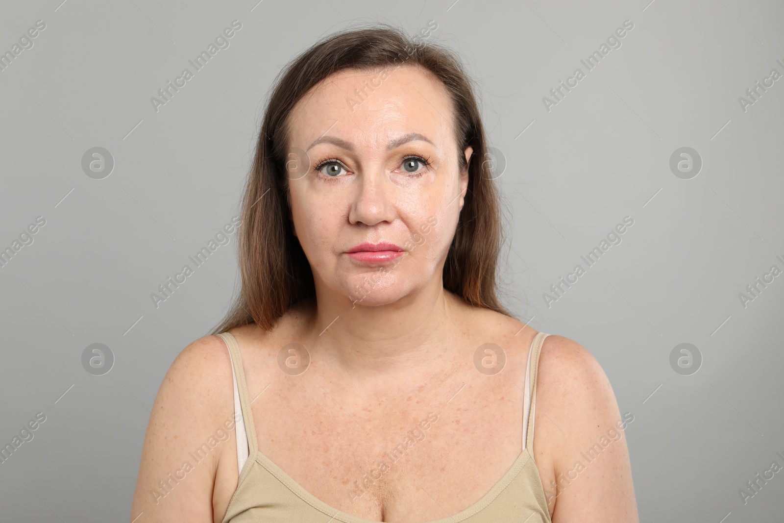 Woman before cosmetic procedure on grey background Photo of Woman before cosmetic procedure on grey background