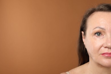 Photo of Woman before cosmetic procedure on brown background, closeup. Space for text