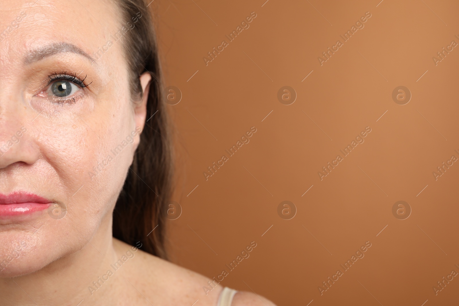 Woman before cosmetic procedure on brown background, closeup. Space for text Photo of Woman before cosmetic procedure on brown background, closeup. Space for text