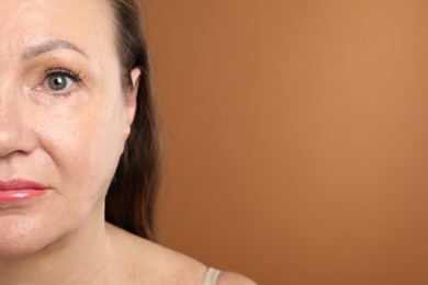 Photo of Woman before cosmetic procedure on brown background, closeup. Space for text