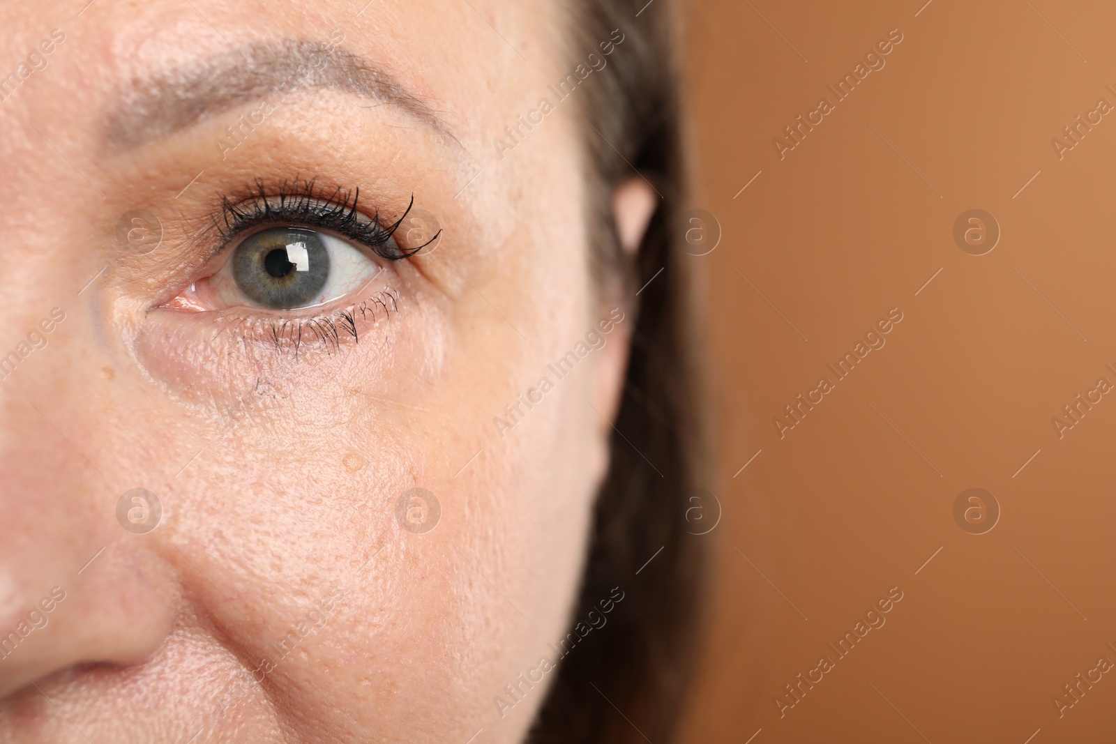 Woman before cosmetic procedure on brown background, closeup. Space for text Photo of Woman before cosmetic procedure on brown background, closeup. Space for text
