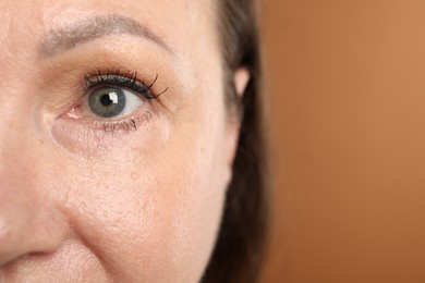 Photo of Woman before cosmetic procedure on brown background, closeup. Space for text