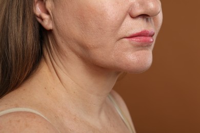Photo of Woman before cosmetic procedure on brown background, closeup