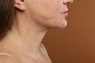 Photo of Woman before cosmetic procedure on brown background, closeup. Space for text