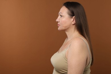 Photo of Woman before cosmetic procedure on brown background, space for text