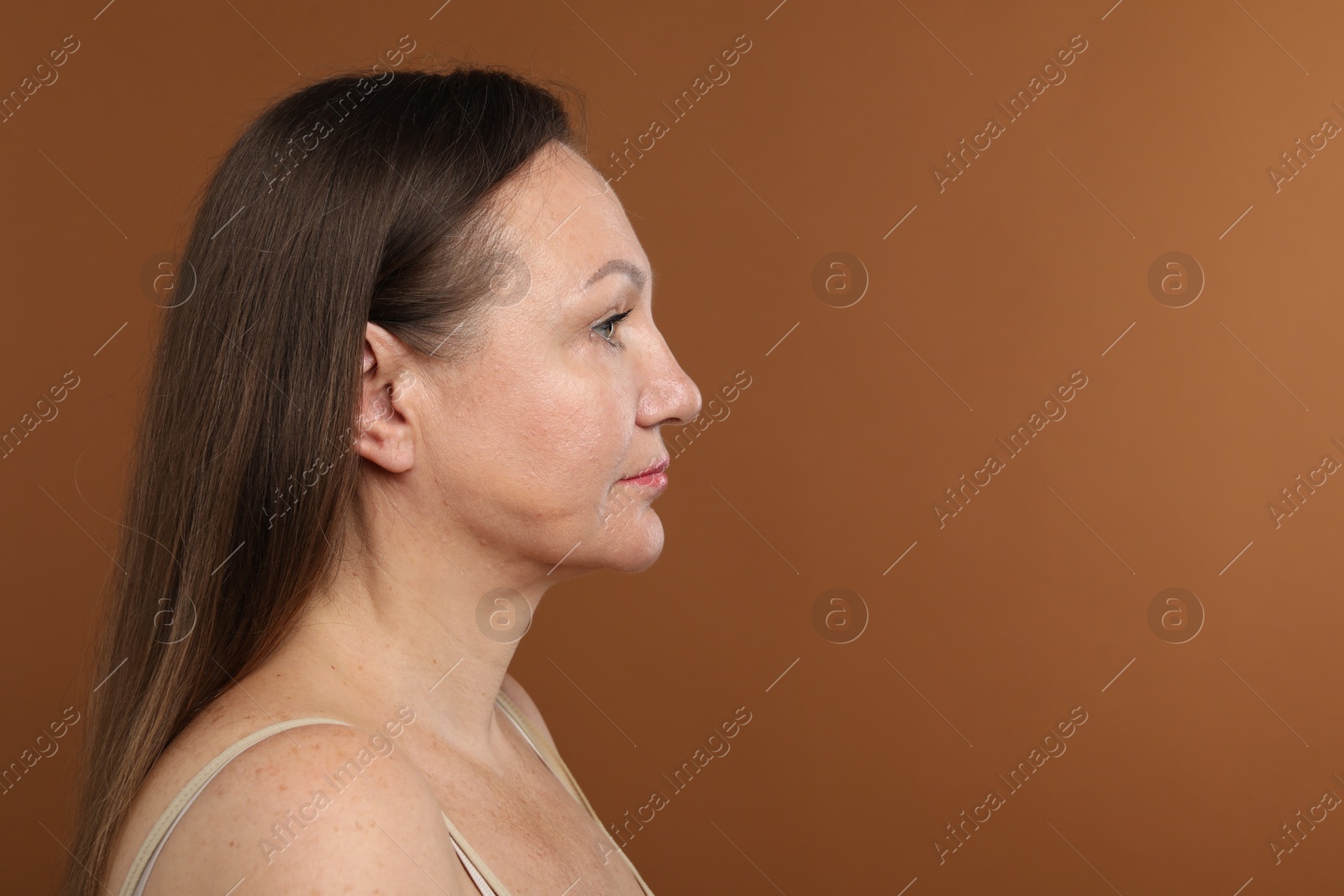 Woman before cosmetic procedure on brown background, space for text Photo of Woman before cosmetic procedure on brown background, space for text