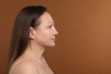 Photo of Woman before cosmetic procedure on brown background, space for text