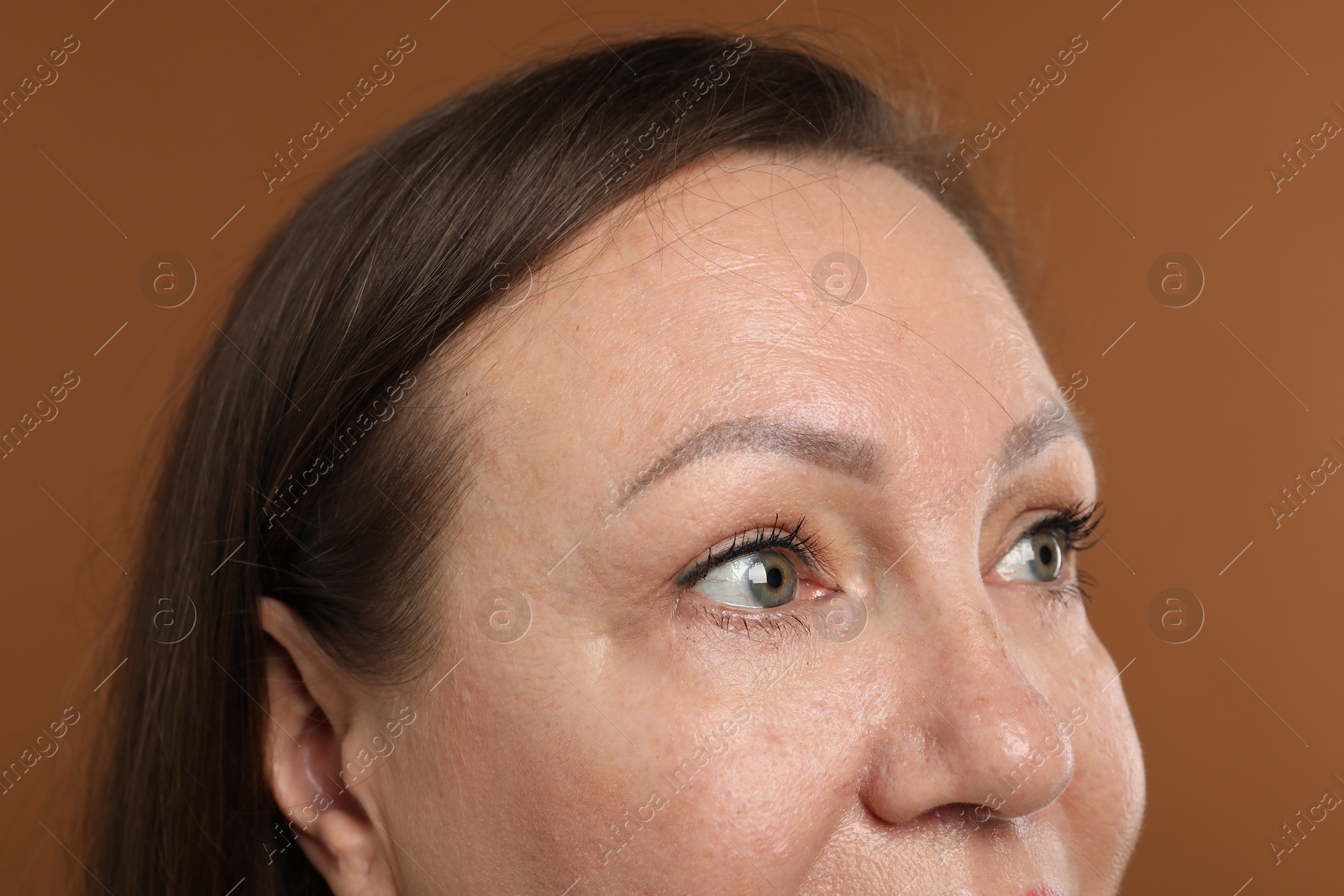 Woman before cosmetic procedure on brown background, closeup Photo of Woman before cosmetic procedure on brown background, closeup