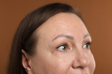 Photo of Woman before cosmetic procedure on brown background, closeup