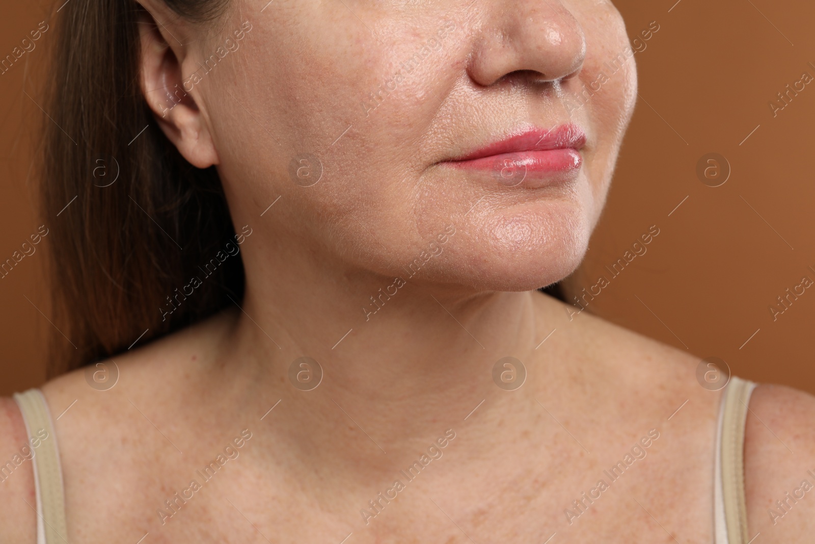 Woman before cosmetic procedure on brown background, closeup Photo of Woman before cosmetic procedure on brown background, closeup