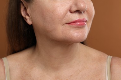 Photo of Woman before cosmetic procedure on brown background, closeup