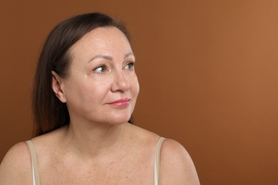 Photo of Woman before cosmetic procedure on brown background. Space for text