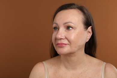 Photo of Woman before cosmetic procedure on brown background. Space for text