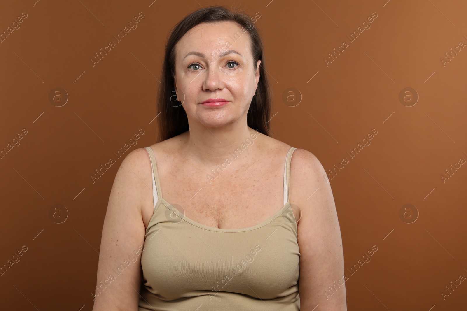 Woman before cosmetic procedure on brown background Photo of Woman before cosmetic procedure on brown background