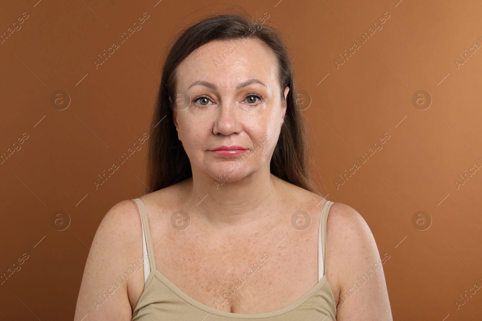 Woman before cosmetic procedure on brown background Photo of Woman before cosmetic procedure on brown background