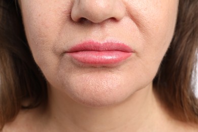 Photo of Closeup view of woman before cosmetic procedure