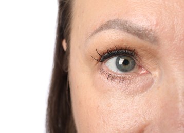 Photo of Woman before cosmetic procedure on white background, closeup