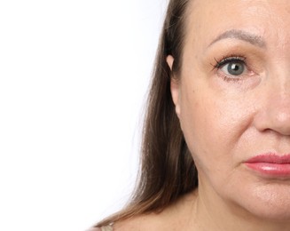 Photo of Woman before cosmetic procedure on white background, closeup