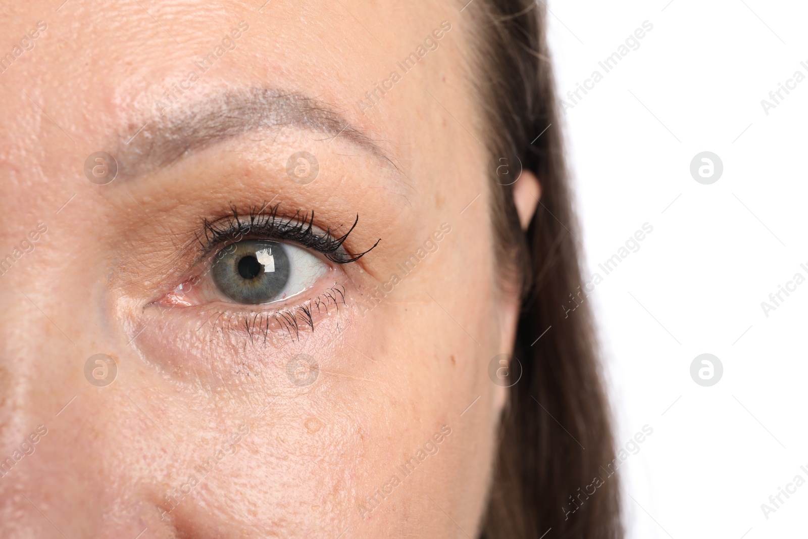 Woman before cosmetic procedure on white background, closeup Photo of Woman before cosmetic procedure on white background, closeup