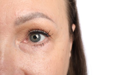 Photo of Woman before cosmetic procedure on white background, closeup
