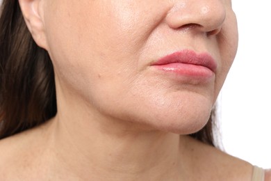 Photo of Woman before cosmetic procedure on white background, closeup