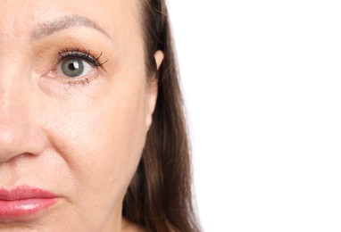 Photo of Woman before cosmetic procedure on white background, closeup