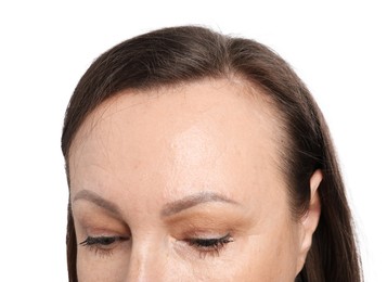 Photo of Woman before rejuvenation on white background, closeup