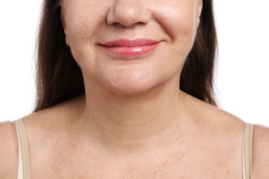 Photo of Woman before cosmetic procedure on white background, closeup