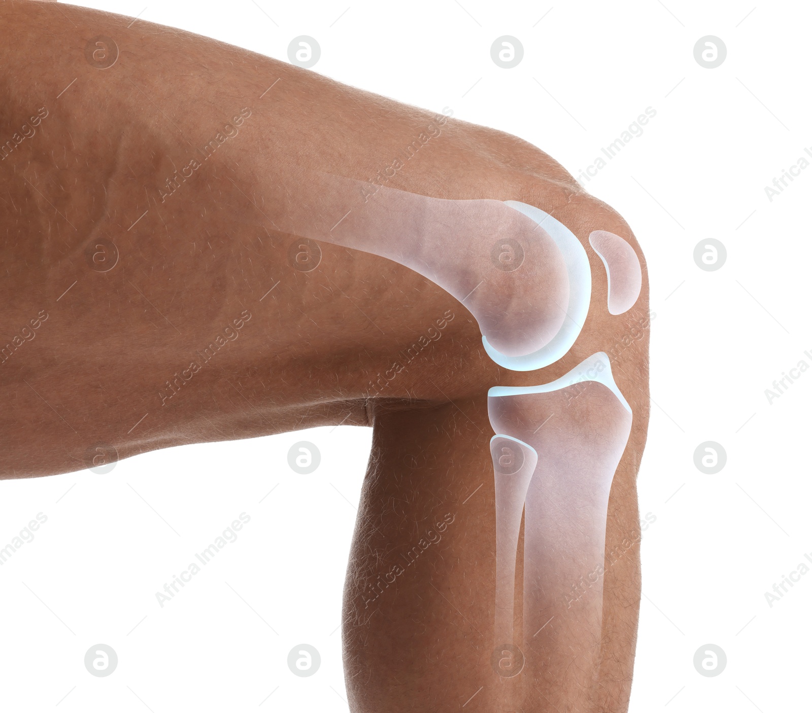 Anatomy of knee. Man with illustration on his leg against white background, closeup Image of Anatomy of knee. Man with illustration on his leg against white background, closeup