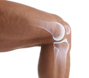 Image of Anatomy of knee. Man with illustration on his leg against white background, closeup