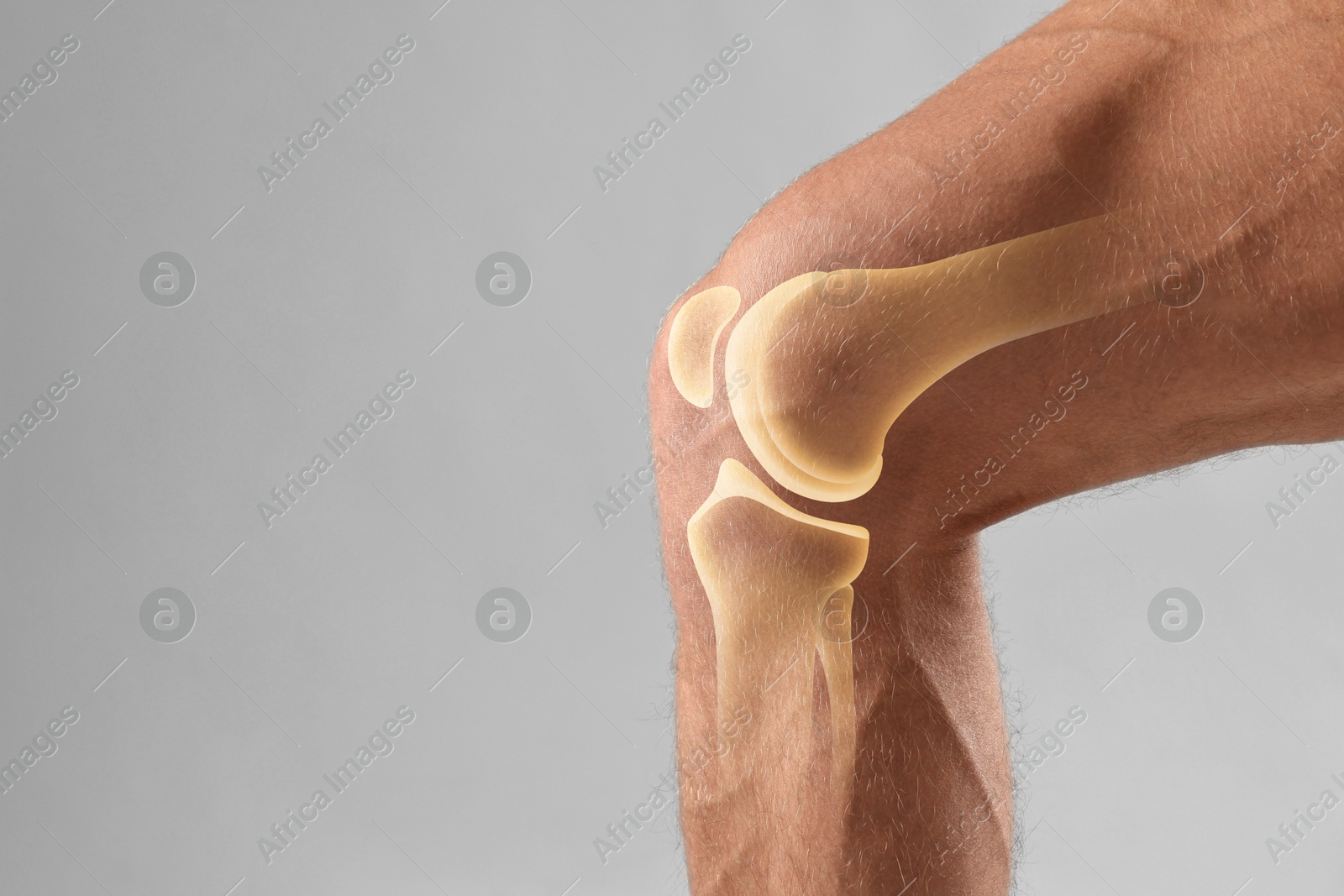 Anatomy of knee. Man with illustration on his leg against grey background, closeup. Space for text Image of Anatomy of knee. Man with illustration on his leg against grey background, closeup. Space for text