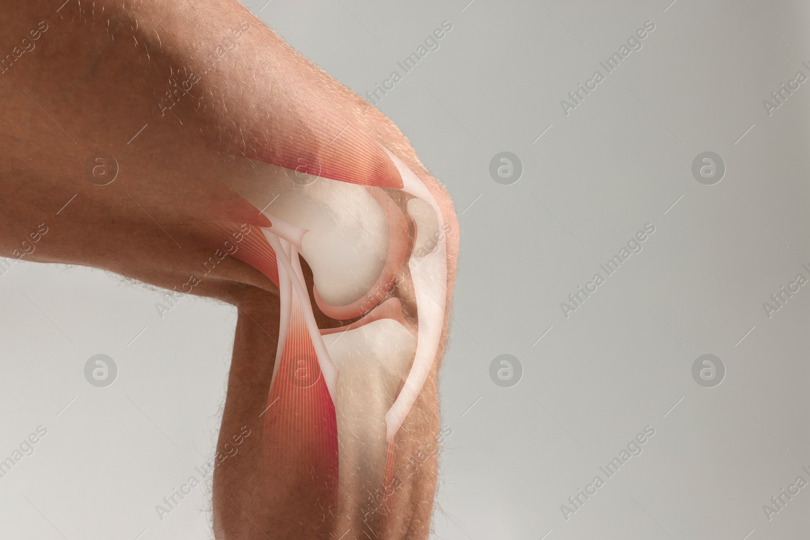 Anatomy of knee. Man with illustration on his leg against grey background, closeup. Space for text Image of Anatomy of knee. Man with illustration on his leg against grey background, closeup. Space for text