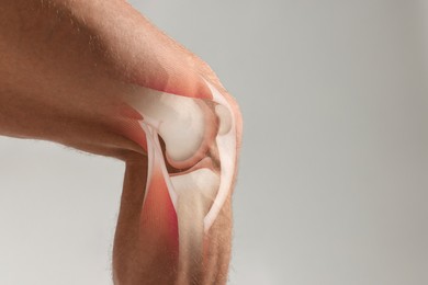 Image of Anatomy of knee. Man with illustration on his leg against grey background, closeup. Space for text
