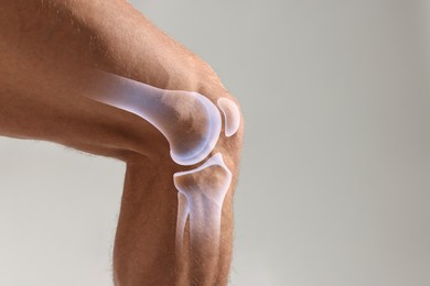 Image of Anatomy of knee. Man with illustration on his leg against grey background, closeup. Space for text