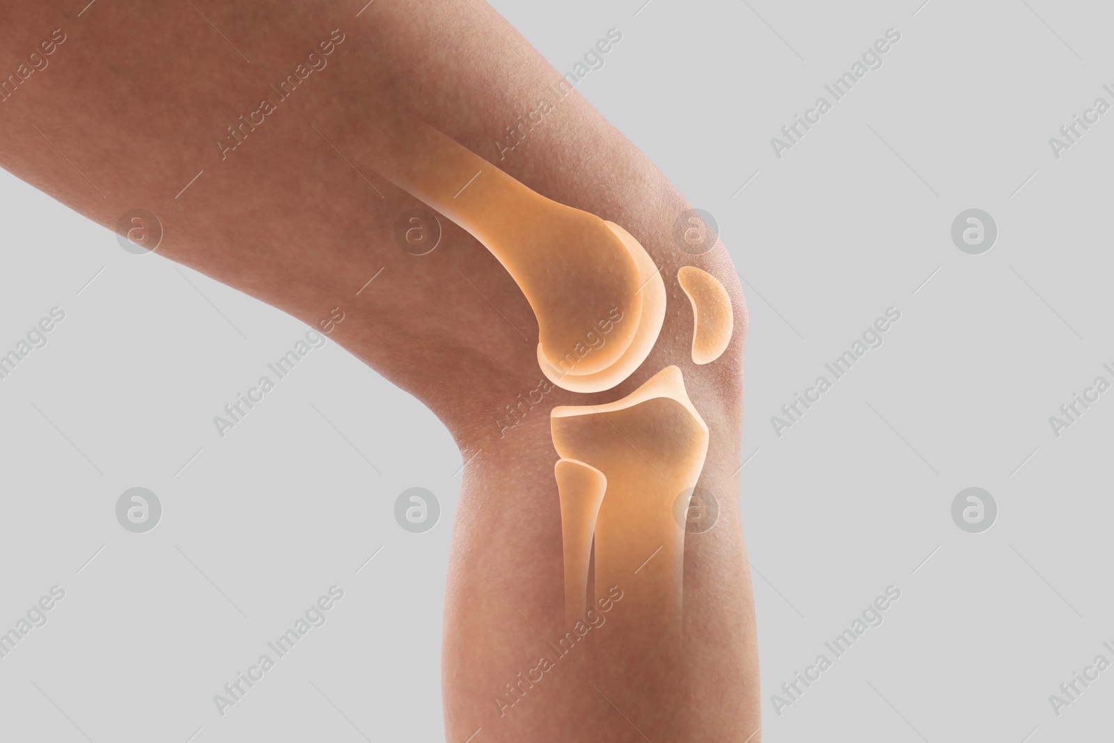 Anatomy of knee. Woman with illustration on her leg against grey background, closeup Image of Anatomy of knee. Woman with illustration on her leg against grey background, closeup