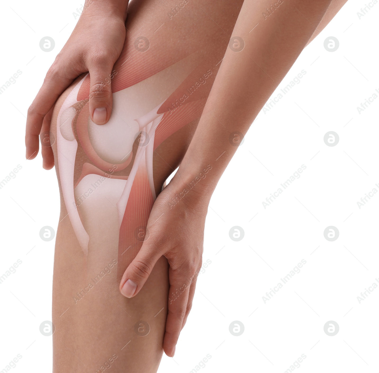Anatomy of knee. Woman with illustration on her leg against white background, closeup Image of Anatomy of knee. Woman with illustration on her leg against white background, closeup