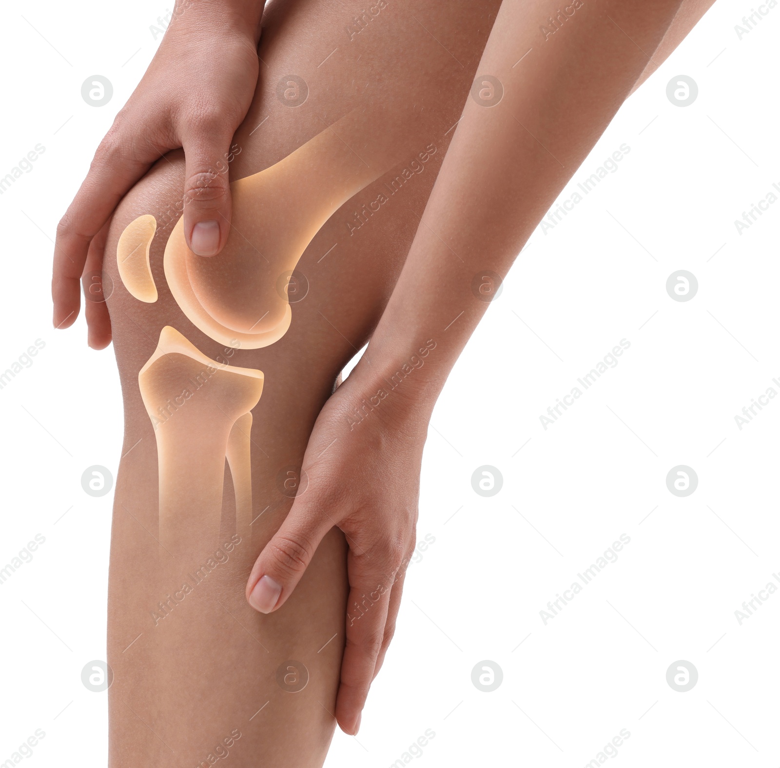 Anatomy of knee. Woman with illustration on her leg against white background, closeup Image of Anatomy of knee. Woman with illustration on her leg against white background, closeup