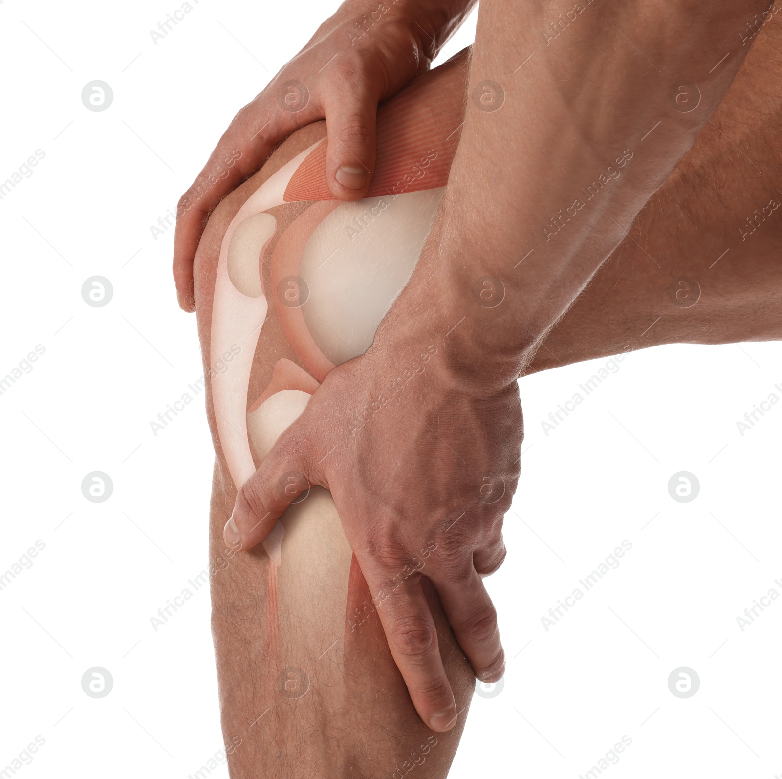 Anatomy of knee. Man with illustration on his leg against white background, closeup Image of Anatomy of knee. Man with illustration on his leg against white background, closeup